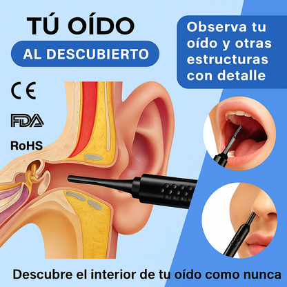 Limpiador de Oídos - Cámara HD